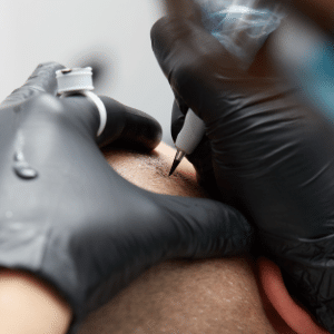 tricopigmentation capillaire, tatoo capillaire