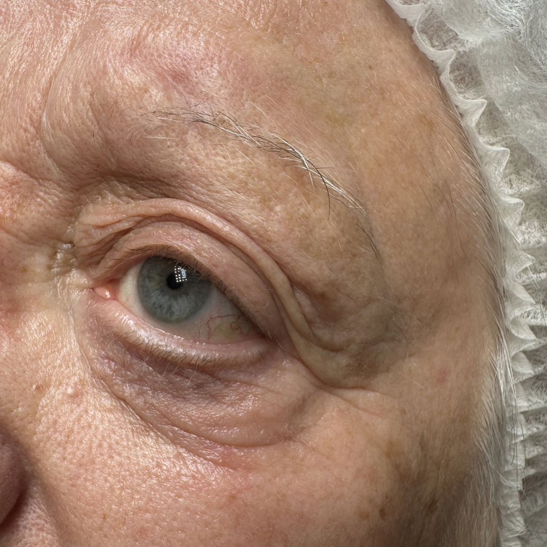 avant maquillage permanent des sourcils