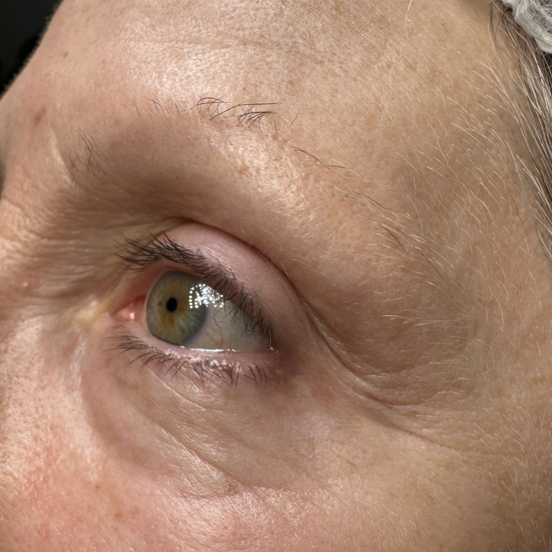 avant maquillage permanent des sourcils